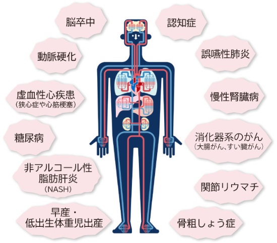 本八幡（市川市）の歯医者、並木デンタルクリニックの歯周病治療