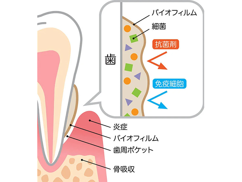 本八幡（市川市）の歯医者、並木デンタルクリニックの予防歯科