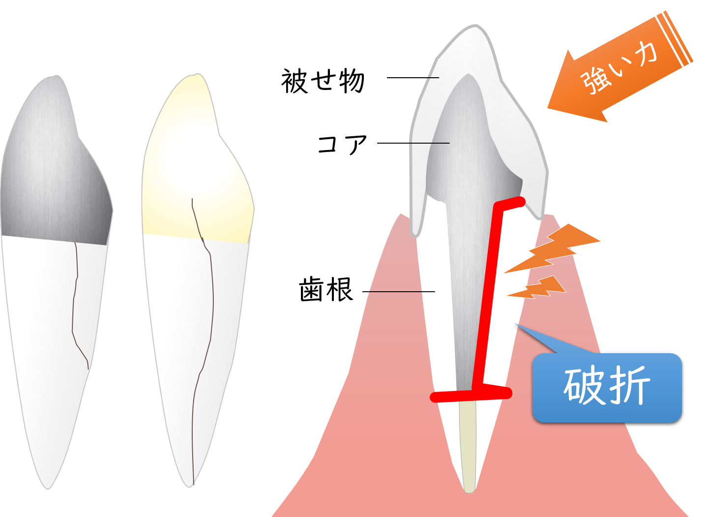 本八幡（市川市）の歯医者、並木デンタルクリニックで歯科用ＣＴ"